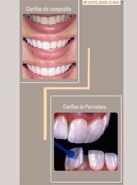 Estética Dental