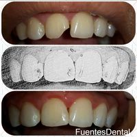 Dentista en Terrassa
