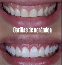 Dentistas en Terrassa